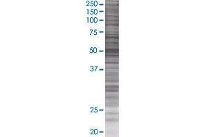 GK2 transfected lysate. (GK2 293T Cell Transient Overexpression Lysate(Denatured))