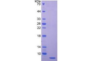 SDS-PAGE analysis of Human C4BPa Protein. (C4BPA Protein)