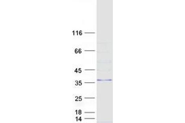 MARCH8 Protein (Transcript Variant 7) (Myc-DYKDDDDK Tag)