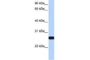 IL13RA2 antibody used at 1 ug/ml to detect target protein. (IL13RA2 Antikörper  (N-Term))