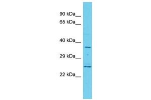 Host: Rabbit Target Name: MRPL44 Sample Type: Hela Whole Cell lysates Antibody Dilution: 1. (MRPL44 Antikörper  (C-Term))