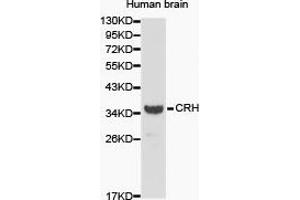 Western Blotting (WB) image for anti-Corticotropin Releasing Hormone (CRH) antibody (ABIN1872000) (CRH Antikörper)