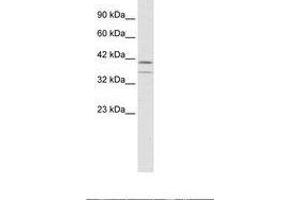 Image no. 1 for anti-CCAAT/enhancer Binding Protein (C/EBP), beta (CEBPB) (AA 239-288) antibody (ABIN6735936) (CEBPB Antikörper  (AA 239-288))