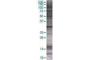 NMNAT1 transfected lysate. (NMNAT1 293T Cell Transient Overexpression Lysate(Denatured))