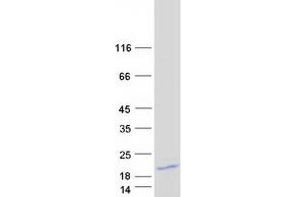 PKIA Protein (Transcript Variant 6) (Myc-DYKDDDDK Tag)