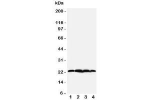 Western blot testing of BAG2 antibody;  Lane 1: rat testis;  2: HeLa;  3: A549;  4: A431 cell lysate. (BAG2 Antikörper  (N-Term))