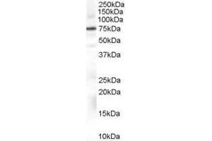 Western Blotting (WB) image for anti-Adrenergic, Beta, Receptor Kinase 1 (ADRBK1) (AA 319-331) antibody (ABIN296681) (GRK2 Antikörper  (AA 319-331))