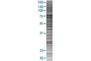 TNXB transfected lysate. (TNXB 293T Cell Transient Overexpression Lysate(Denatured))