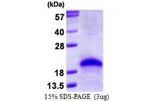 Figure annotation denotes ug of protein loaded and % gel used. (VEGF 165 Protein)