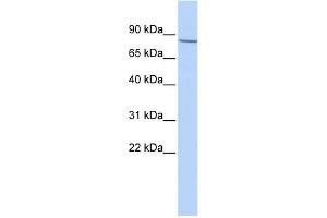 WB Suggested Anti-APP Antibody Titration: 0. (APP Antikörper  (Middle Region))