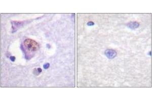 Immunohistochemistry analysis of paraffin-embedded human brain tissue, using SOX9 (Ab-181) Antibody. (SOX9 Antikörper  (AA 147-196))