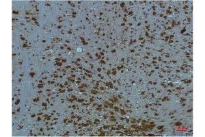 Immunohistochemical analysis of paraffin-embedded Mouse BrainTissue using PI3 Kinase P85 α Mouse mAb diluted at 1:200. (PIK3R1 Antikörper)