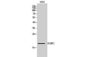 Western Blotting (WB) image for anti-Glucuronidase, beta Pseudogene 1 (GUSBP1) (Internal Region) antibody (ABIN6283061) (GUSBP1 Antikörper  (Internal Region))