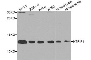 Western blot analysis of extracts of various cell lines, using ATPIF1 antibody. (ATPase Inhibitory Factor 1 Antikörper  (AA 26-106))