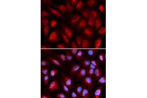 Immunofluorescence analysis of U2OS cells using MCM5 antibody. (MCM5 Antikörper)