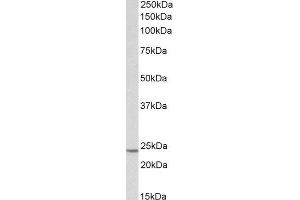 ABIN2560421 (0. (TIMP1 Antikörper  (AA 129-143))