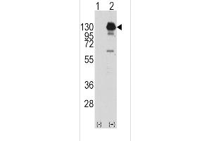 Western blot analysis of PDGFRA using rabbit polyclonal PDGFRA Antibody (Y762) using 293 cell lysates (2 ug/lane) either nontransfected (Lane 1) or transiently transfected with the PDGFRA gene (Lane 2). (PDGFRA Antikörper  (AA 740-769))