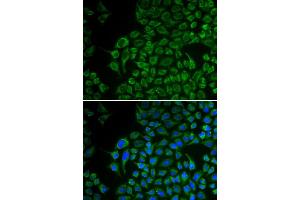 Immunofluorescence analysis of U2OS cells using TYR antibody (ABIN5970593). (TYR Antikörper)