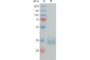 Human PRLR Protein, His Tag on SDS-PAGE under reducing condition. (Prolactin Receptor Protein (PRLR) (AA 25-234) (His tag))