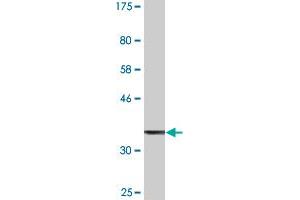 Western Blot detection against Immunogen (37. (ZBTB33 Antikörper  (AA 564-673))