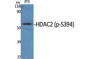 Western Blot (WB) analysis of specific cells using Phospho-HDAC2 (S394) Polyclonal Antibody. (HDAC2 Antikörper  (pSer394))