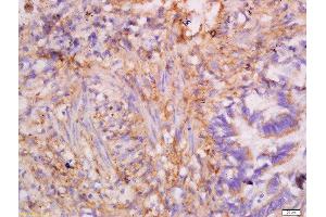 Immunohistochemistry (Paraffin-embedded Sections) (IHC (p)) image for anti-Keratin 7 (KRT7) (AA 251-350) antibody (ABIN732023)