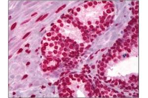 Immunohistochemical analysis using Histone H3 antibody at 5 µg/ml on Human Prostate tissue (Formalin-fixed, Paraffin-embedded). (Histone 3 Antikörper)