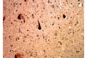 MCA-Ubi-1 staining of cerebral cortex of an Alzheimer patient. (Ubiquitin Antikörper)