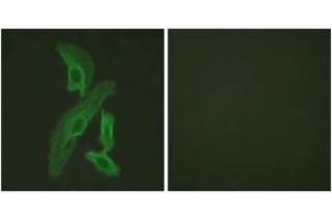 Immunofluorescence analysis of HeLa cells, using BCL-XL (Ab-47) Antibody. (BCL2L1 Antikörper  (AA 13-62))