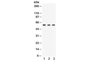 Western blot testing of 1) rat brain, 2) mouse brain and 3) human HeLa lysate with TCP1 delta antibody. (CCT4 Antikörper)