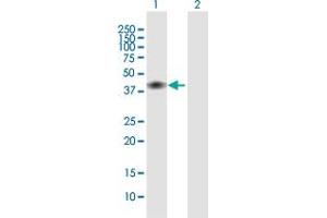 Western Blot analysis of CD28 expression in transfected 293T cell line by CD28 MaxPab polyclonal antibody. (CD28 Antikörper  (AA 1-220))