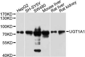 Western blot analysis of extracts of various cell lines, using UGT1A1 antibody (ABIN1875274) at 1:1000 dilution. (UGT1A1 Antikörper)