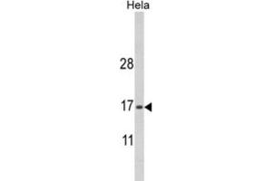 Western Blotting (WB) image for anti-MpV17 Mitochondrial Inner Membrane Protein (MPV17) antibody (ABIN3003896) (MPV17 Antikörper)