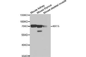 Western blot analysis of extracts of various cell lines, using KRT5 antibody (ABIN5971441) at 1/500 dilution. (Cytokeratin 5 Antikörper)