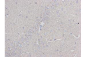 Immunohistochemistry (IHC) image for anti-Tubulin, beta 3 (TUBB3) (N-Term) antibody (ABIN1854950) (TUBB3 Antikörper  (N-Term))