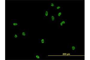 Immunofluorescence (IF) image for anti-CSE1 Chromosome Segregation 1-Like (CSE1L) (AA 872-971) antibody (ABIN560494)