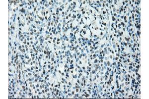 Image no. 1 for anti-B-Raf proto-oncogene, serine/threonine kinase (BRAF) antibody (ABIN1496959) (BRAF Antikörper)