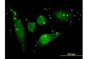 Immunofluorescence of monoclonal antibody to FGFR2 on HeLa cell. (FGFR2 Antikörper  (AA 621-723))