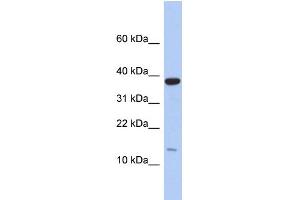 WB Suggested Anti-RPL27 Antibody Titration: 0. (RPL27 Antikörper  (Middle Region))