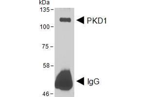 Western Blotting (WB) image for anti-Protein Kinase D1 (PRKD1) (AA 233-246) antibody (ABIN5874190) (PKC mu Antikörper  (AA 233-246))