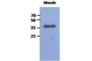 Image no. 1 for anti-Fructose-1,6-Bisphosphatase 2 (FBP2) (AA 1-339), (N-Term) antibody (ABIN1449408) (FBP2 Antikörper  (N-Term))
