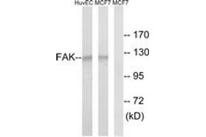 Western Blotting (WB) image for anti-PTK2 Protein tyrosine Kinase 2 (PTK2) (AA 809-858) antibody (ABIN2889088) (FAK Antikörper  (AA 809-858))