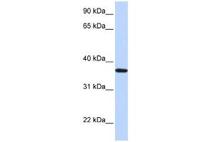 WB Suggested Anti-LCN12 Antibody Titration: 0. (LCN12 Antikörper  (N-Term))