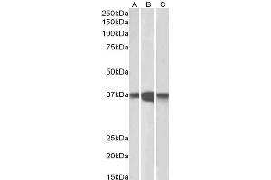 Western Blotting (WB) image for anti-Protein Phosphatase 2, Catalytic Subunit, alpha Isozyme (PPP2CA) antibody (ABIN5930556) (PPP2CA Antikörper)