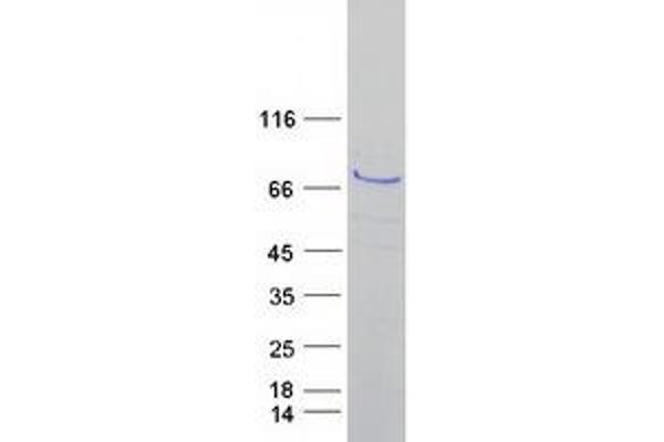 ALOX15 Protein (Myc-DYKDDDDK Tag)