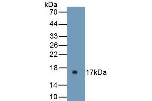 Detection of Recombinant UPK1A, Mouse using Polyclonal Antibody to Uroplakin 1A (UPK1A) (UPK1A Antikörper  (AA 116-231))