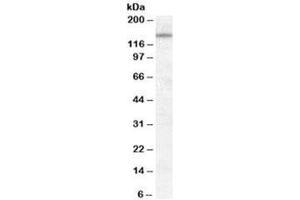 Western blot testing of KELLY cell lysate with DLG1 antibody at 0. (DLG1 Antikörper)