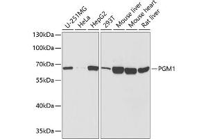 Western blot analysis of extracts of various cell lines, using PGM1 antibody  at 1:1000 dilution. (Phosphoglucomutase 1 Antikörper  (AA 1-300))