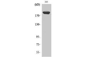 Western Blotting (WB) image for anti-Insulin Receptor Substrate 1 (IRS1) (Ser62) antibody (ABIN3185240) (IRS1 Antikörper  (Ser62))