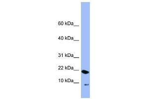 PIN4 antibody used at 1 ug/ml to detect target protein. (PIN4 Antikörper  (N-Term))